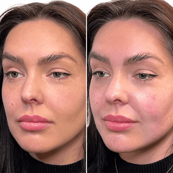 SKINVIVE